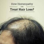 Baal Jhadne Ki Dawa Homeopathic – Hair Fall Homeopathic Medicine