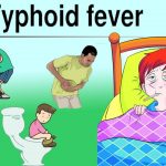 about typhoid in hindi