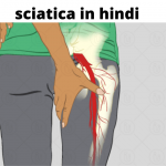 sciatica in hindi