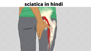 sciatica in hindi